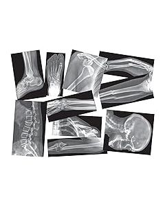 Roylco True To Life Human X-Rays, 18pk of reproducible worksheets and guide. R5911